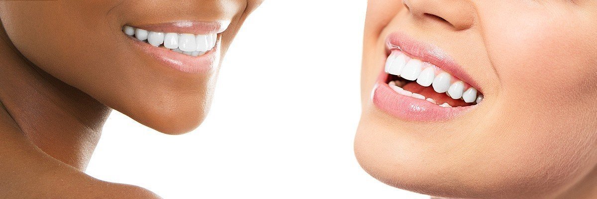 Lindsay Dental Restoration
